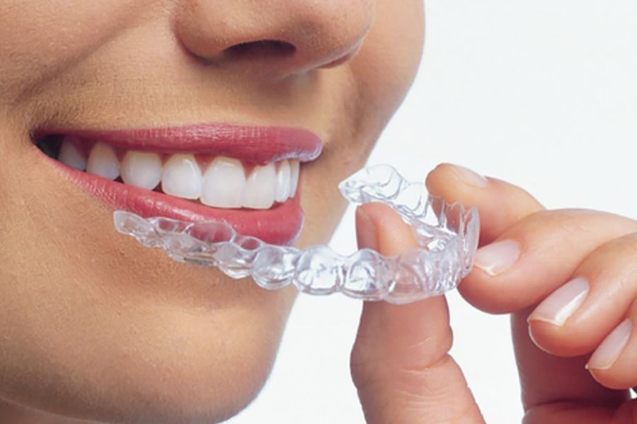 Invisalign Şeffaf Plak Tedavisi